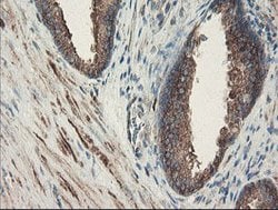 SENP2 Mouse anti-Human, Clone: OTI1B8, lyophilized, TrueMAB 100 &mu;g;