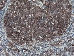 SENP2 Mouse anti-Human, Clone: OTI1B8, lyophilized, TrueMAB 100 &mu;g;