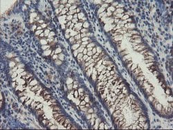 SENP2 Mouse anti-Human, Clone: OTI1B8, lyophilized, TrueMAB 100 &mu;g;