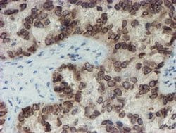 SENP2 Monoclonal Antibody (OTI3D3), TrueMAB , OriGene:Antibodies:Primary