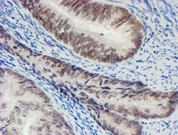 SENP2 Monoclonal Antibody (OTI3D3), TrueMAB , OriGene 100 &mu;L; Unconjugated:Antibodies,