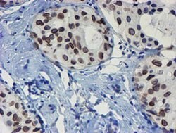 SENP2 Monoclonal Antibody (OTI3D3), TrueMAB , OriGene 100 &mu;L; Unconjugated:Antibodies,