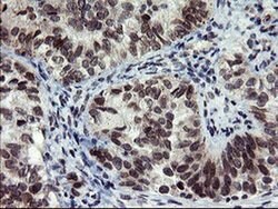 SENP2 Monoclonal Antibody (OTI5G8), TrueMAB , OriGene 100 &mu;L; Unconjugated:Antibodies,