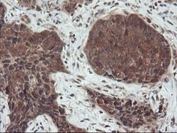 SENP2 Monoclonal Antibody (OTI3E7), TrueMAB , OriGene 100 &mu;L; Unconjugated:Antibodies,