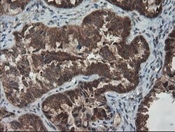 SENP2 Monoclonal Antibody (OTI3E7), TrueMAB , OriGene 100 &mu;L; Unconjugated:Antibodies,