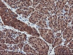 SENP2 Monoclonal Antibody (OTI3E7), TrueMAB , OriGene 100 &mu;L; Unconjugated:Antibodies,