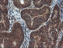 SENP2 Monoclonal Antibody (OTI3E7), TrueMAB , OriGene 100 &mu;L; Unconjugated:Antibodies,