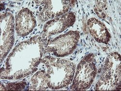 SENP2 Monoclonal Antibody (OTI3E7), TrueMAB , OriGene 100 &mu;L; Unconjugated:Antibodies,