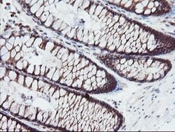 SENP2 Monoclonal Antibody (OTI3E7), TrueMAB , OriGene 100 &mu;L; Unconjugated:Antibodies,