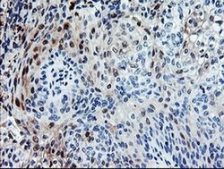 SENP2 Monoclonal Antibody (OTI5E1), TrueMAB , OriGene 100 &mu;L; Unconjugated:Antibodies,