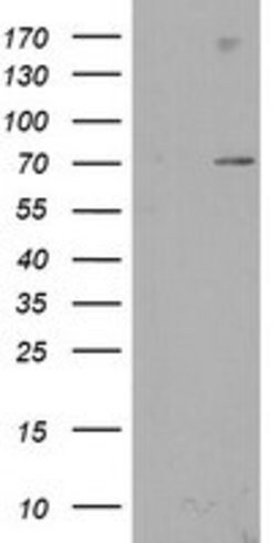 SENP2 Mouse anti-Human, Clone: OTI3F5, lyophilized, TrueMAB 100 &mu;g;