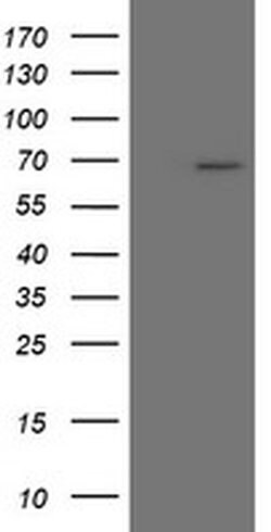 SENP2 Monoclonal Antibody (OTI1H1), TrueMAB , OriGene 100 &mu;L; Unconjugated:Anticuerpos
