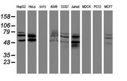 SENP2 Monoclonal Antibody (OTI3D3), TrueMAB , OriGene 100 &mu;L; Unconjugated:Antibodies,