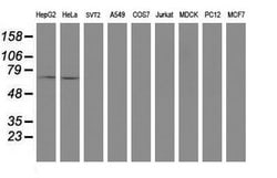 SENP2 Mouse anti-Human, Clone: OTI5G8, lyophilized, TrueMAB 100 &mu;g;