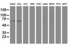 SENP2 Monoclonal Antibody (OTI5G8), TrueMAB , OriGene 100 &mu;L; Unconjugated:Antibodies,