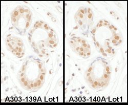 SENP3 Rabbit anti-Human, Polyclonal, Bethyl Laboratories 100 &mu;L; Unconjugated:Antibodies,