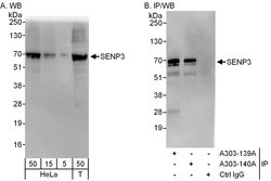 SENP3 Rabbit anti-Human, Polyclonal, Bethyl Laboratories 100 &mu;L; Unconjugated:Antibodies,