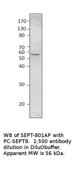 Septin 8 Rabbit anti-Human, Mouse, Rat, Polyclonal, FabGennix 200 &mu;L;