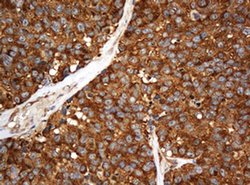 SERBP1 Monoclonal Antibody (OTI1E7), TrueMAB , OriGene 100 &mu;L; Unconjugated:Antibodies,