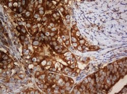 SERBP1 Monoclonal Antibody (OTI1E7), TrueMAB , OriGene:Antibodies:Primary