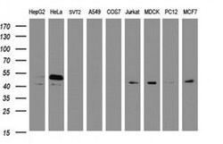 SERBP1 Monoclonal Antibody (OTI4F8), TrueMAB , OriGene 100 &mu;L; Unconjugated:Antibodies,