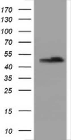SERBP1 Mouse anti-Human, Clone: OTI2C11, lyophilized, TrueMAB 100 &mu;g;