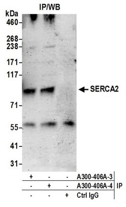 SERCA2 Rabbit anti-Human, Polyclonal, Bethyl Laboratories 100 &mu;L; Unconjugated:Antibodies,