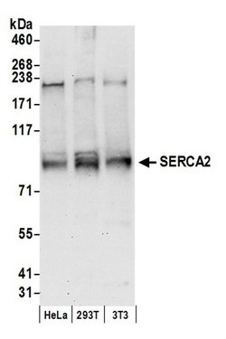 SERCA2 Rabbit anti-Human, Polyclonal, Bethyl Laboratories 100 &mu;L; Unconjugated:Antibodies,