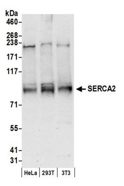 SERCA2 Polyclonal Antibody, Bethyl Laboratories 20 &mu;L; Unconjugated:Antibodies,