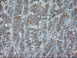 SERPINA1 Mouse anti-Canine, Human, Clone: OTI5B12, lyophilized, TrueMAB