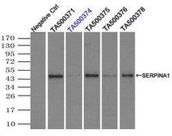 SERPINA1 Mouse anti-Canine, Human, Clone: OTI9A1, lyophilized, TrueMAB