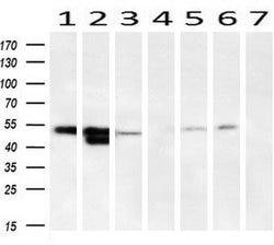 SERPINA1 Mouse anti-Canine, Human, Clone: OTI9A1, lyophilized, TrueMAB