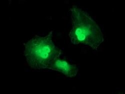 SERPINA5 Monoclonal Antibody (OTI1F8), TrueMAB , OriGene 30 &mu;L; Unconjugated:Antibodies,