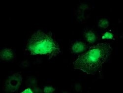 SERPINB1 Monoclonal Antibody (OTI1D1), TrueMAB , OriGene 100 &mu;L; Unconjugated:Antibodies,