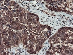 SERPINB1 Monoclonal Antibody (OTI4B3), TrueMAB , OriGene 100 &mu;L; Unconjugated:Antibodies,