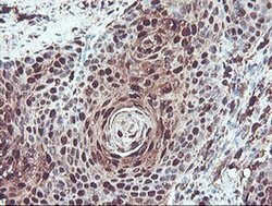 SERPINB1 Monoclonal Antibody (OTI4B3), TrueMAB , OriGene 100 &mu;L; Unconjugated:Antibodies,
