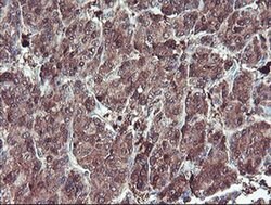 SERPINB1 Monoclonal Antibody (OTI4B3), TrueMAB , OriGene 100 &mu;L; Unconjugated:Antibodies,