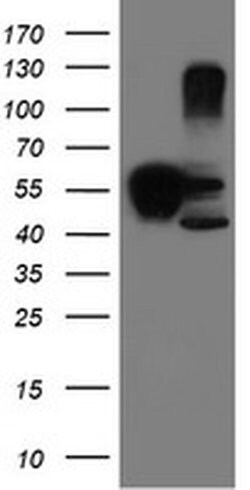 SERPINB1 Monoclonal Antibody (OTI4B3), TrueMAB , OriGene 100 &mu;L; Unconjugated:Antibodies,