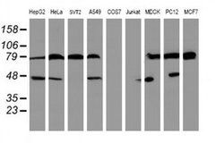 SERPINB1 Monoclonal Antibody (OTI4B3), TrueMAB , OriGene 100 &mu;L; Unconjugated:Antibodies,