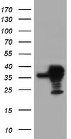 SERPINB1 Monoclonal Antibody (OTI1D1), TrueMAB , OriGene 100 &mu;L; Unconjugated:Antibodies,