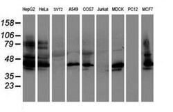SERPINB1 Monoclonal Antibody (OTI1D1), TrueMAB , OriGene 100 &mu;L; Unconjugated:Antibodies,