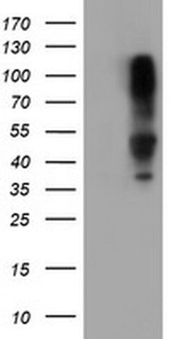 SERPINB1 Monoclonal Antibody (OTI2D11), TrueMAB , OriGene 100 &mu;L; Unconjugated:Antibodies,