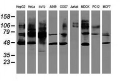 SERPINB1 Monoclonal Antibody (OTI2D11), TrueMAB , OriGene 100 &mu;L; Unconjugated:Antibodies,