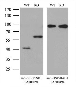 SERPINB1 Monoclonal Antibody (OTI2D11), TrueMAB , OriGene 100 &mu;L; Unconjugated:Antibodies,