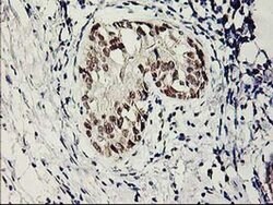 SERPINB13 Monoclonal Antibody (OTI2B6), TrueMAB , OriGene:Antibodies:Primary