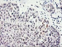 SERPINB13 Monoclonal Antibody (OTI2B6), TrueMAB , OriGene 30 &mu;L; Unconjugated:Antibodies,