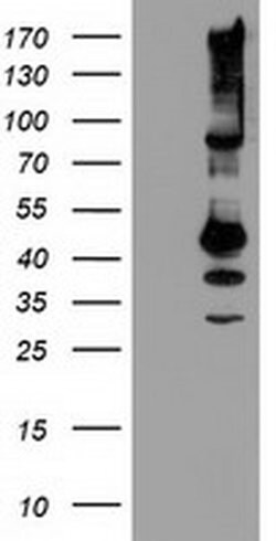 SERPINB13 Monoclonal Antibody (OTI2B6), TrueMAB , OriGene 30 &mu;L; Unconjugated:Antibodies,