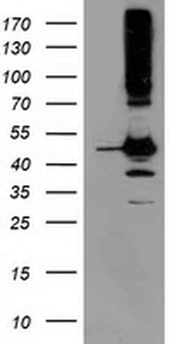 SERPINB13 Monoclonal Antibody (OTI2F5), TrueMAB , OriGene 100 &mu;L; Unconjugated:Antibodies,