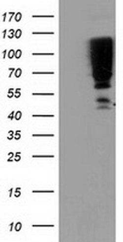 SERPINB13 Monoclonal Antibody (OTI1B12), TrueMAB , OriGene 100 &mu;L | Buy Online | Origene Technologies | Fisher Scientific
