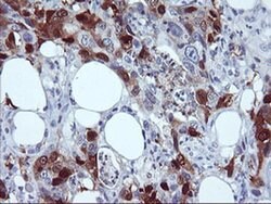 SERPINB2 Monoclonal Antibody (OTI3H1), TrueMAB , OriGene:Antibodies:Primary